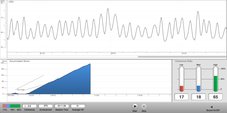 Heart Rate Variability